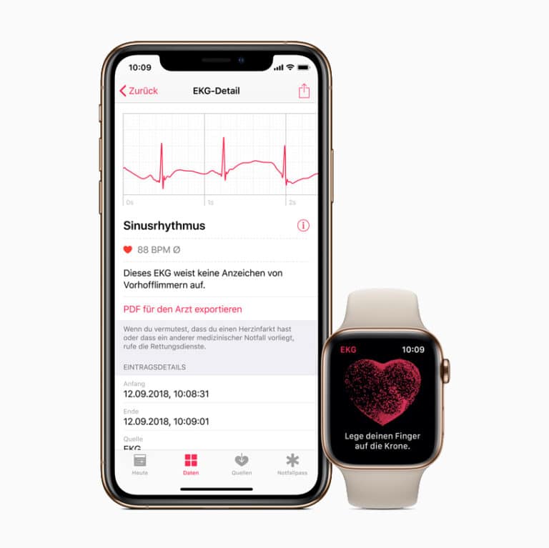 Which Apple Watch Has ECG Functionality?