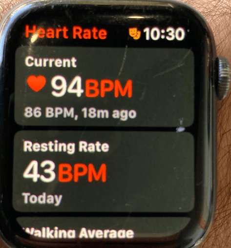 Can Your Apple Watch Take Your Blood Pressure?